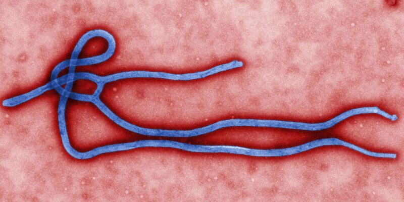 Em meio a surto de ebola, Uganda registra 5 mortes pela doença
