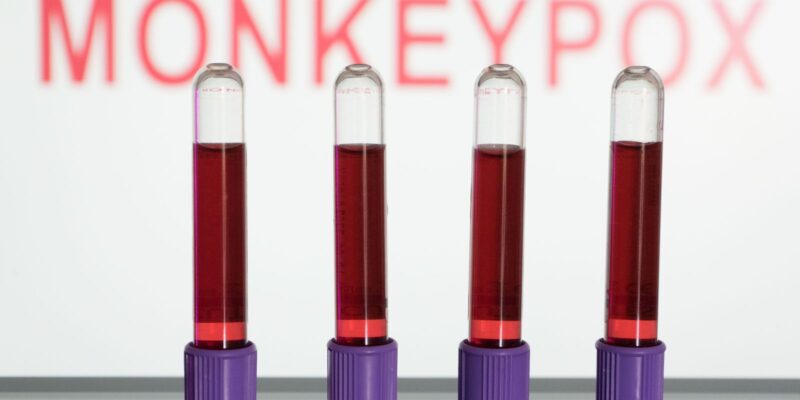 Estudo aborda transmissão de varíola dos macacos por superfície