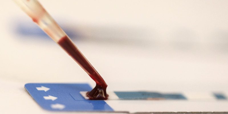 Unicef: maioria de jovens com HIV aprova acolhida em serviços de saúde