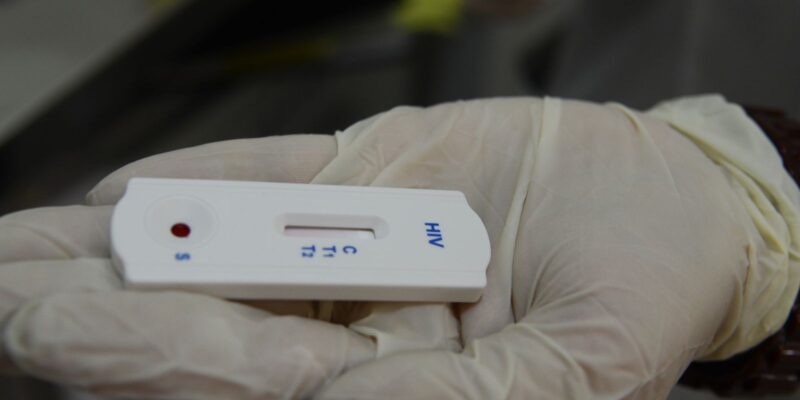 Saúde orienta farmácias sobre testes para HIV, sífilis e hepatites