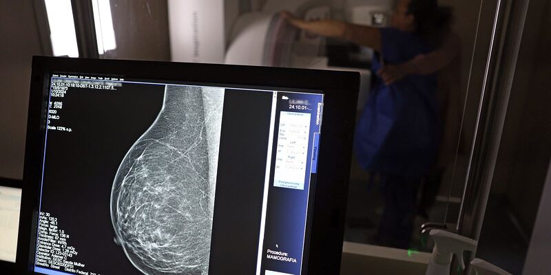 AGU processa médico que apontou mamografia como causadora de câncer