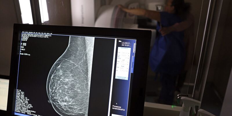 Nova lei reforça direito a três folgas por ano para exames preventivos