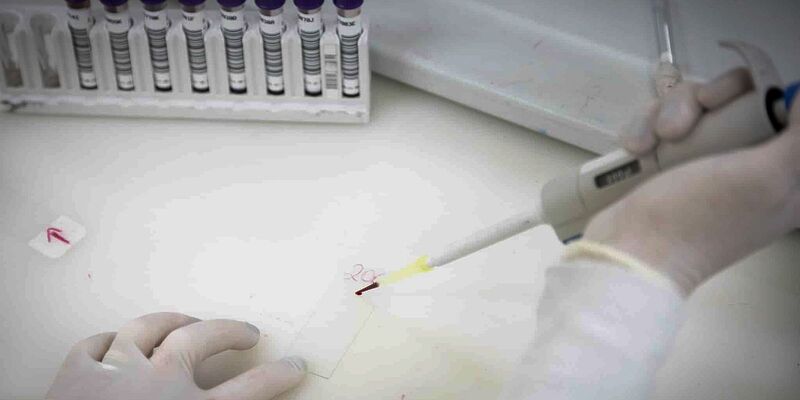 Paciente em SP com suspeita de ebola testa positivo para meningite